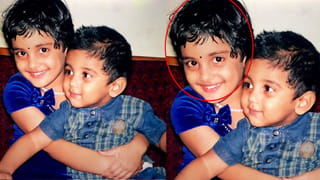 Salaar Movie: సలార్ నటికి యాక్సిడెంట్.. ముఖం నిండా గాయాలు.. వీడియో వైరల్..