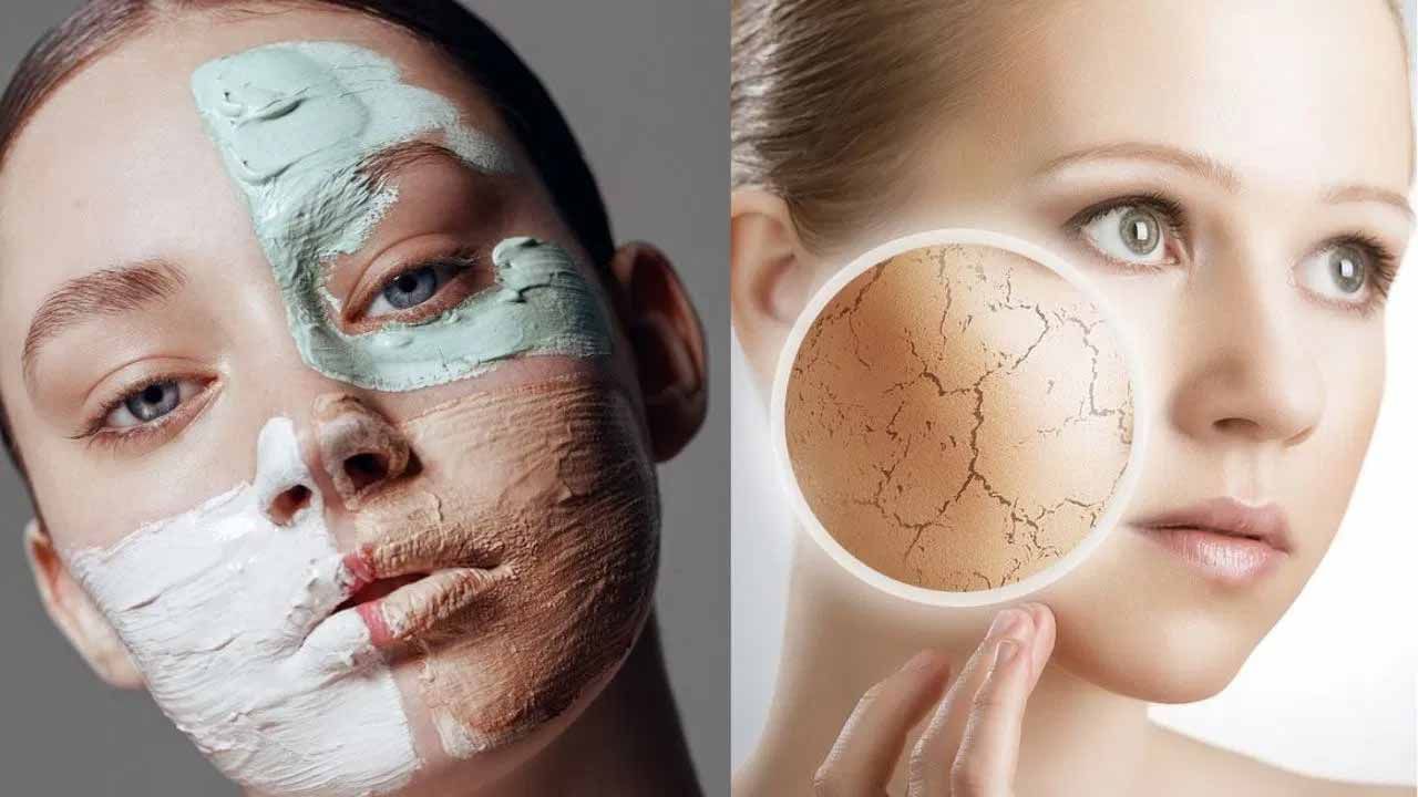 వైట్‌ హెడ్స్ తొలగించడానికి కార్న్‌ఫ్లోర్‌, వెనిగర్ ఉపయోగించవచ్చు. ఈ ప్యాక్ చేయడానికి కార్న్‌ఫ్లోర్‌ను వెనిగర్‌తో పేస్ట్‌లా కలుపుకోవాలి. తర్వాత ఈ మిశ్రమాన్ని బాగా మిక్స్ చేసి స్క్రబ్ లా ఉపయోగించాలి. వారానికి 3 సార్లు స్నానం చేసే ముందు దీనిని ఉపయోగిస్తే బ్లాక్ అండ్ వైట్ హెడ్స్ సమస్య పోతుంది.