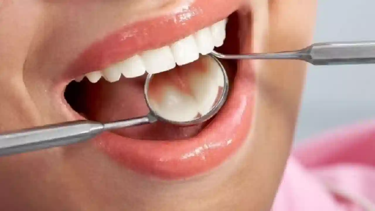 Foods For Teeth: మీ పళ్లు ముత్యాల్లా మెరవాలంటే.. ఈ టిప్స్‌ని ఫాలో అవ్వాల్సిందే!