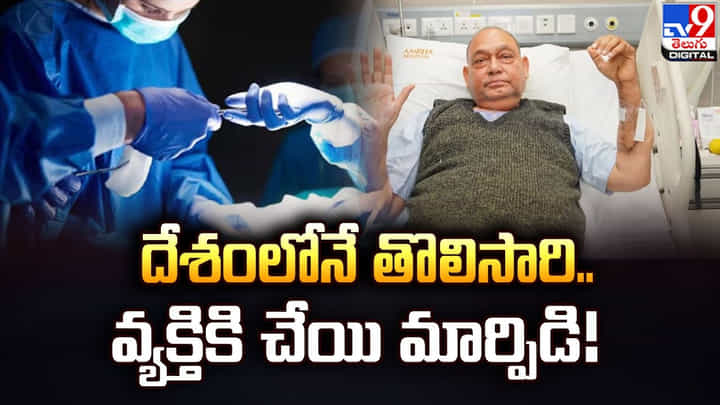 దేశంలోనే అరుదైన శస్త్ర చికిత్స.. వ్యక్తికి చేయి మార్పిడి దేశంలోనే అరుదైన శస్త్ర చికిత్స.. వ్యక్తికి చేయి మార్పిడి