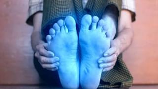 Skin Care: ఈ చౌవకైన వస్తువులతో మీ ముఖాన్ని చంద్రబింబంలా మెరిపించండి!