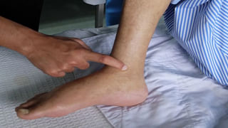 Health: అమ్మో.. ఈ పదార్థాలను తింటే 32రకాల వ్యాధులను ఆహ్వానిస్తున్నట్లే.. నెమ్మదిగా ప్రాణాలు పోతాయట..