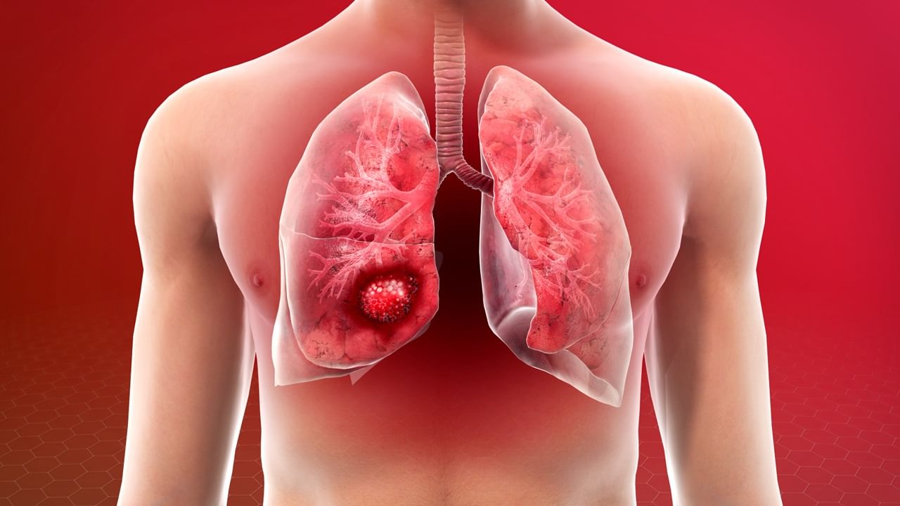 Lungs Health: ఊపిరితిత్తులు ఆరోగ్యంగా ఉండాలంటే.. మిస్ చేయకుండా వీటిని చేయండి!