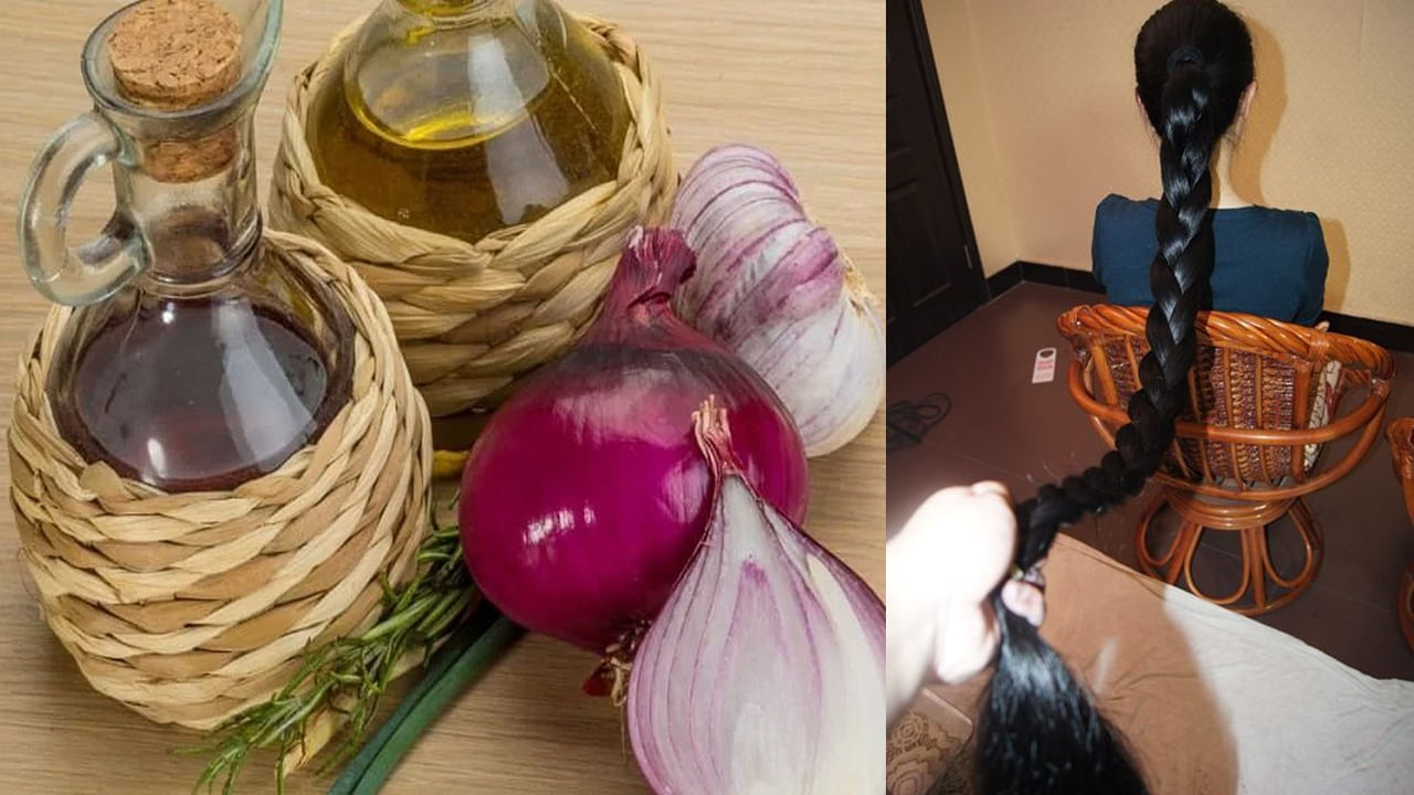 Onion Hair Oil: జుట్టు బాగా ఊడిపోతోందా.. ఉల్లి నూనె బెస్ట్ మెడిసిన్.. ఇంట్లోనే తయారు చేసుకోండి ఇలా