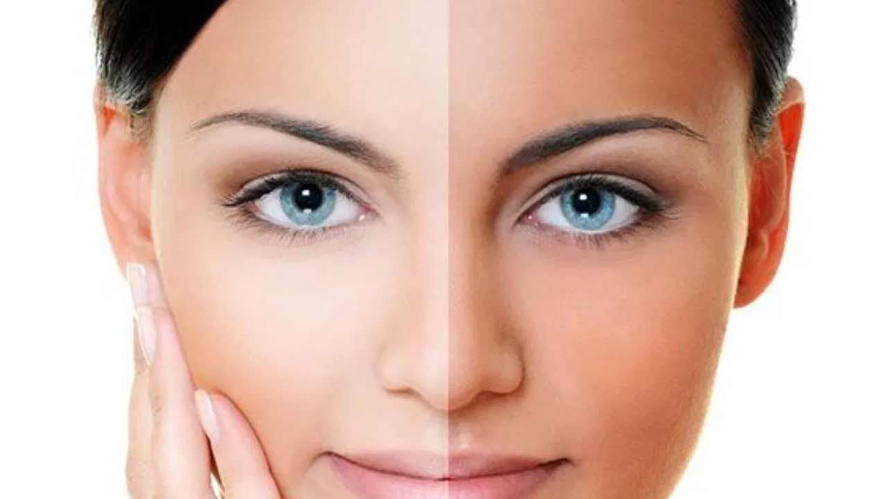 చాలా మంది పార్లర్‌కు వెళ్లి టాన్ రిమూవల్ ఫేషియల్ చేయించుకుంటారు. కానీ ఇలా చేయడం వల్ల డబ్బు ఖర్చు చేయవల్సి వస్తుంది. అయితే రూపాయి ఖర్చు లేకుండా ఇంట్లో కూడా టాన్ తొలగించవచ్చు. ఇంట్లోనే టాన్ తొలగించడానికి పుల్లని పెరుగు, నిమ్మకాయ ఉంటే సరిపోతుంది. ఈ రెండు పదార్థాలు టాన్‌ను తొలగించడానికి సహాయపడతాయి. ఒక గిన్నెలో పుల్లని పెరుగు తీసుకుని, అందులో కొన్ని చుక్కల నిమ్మరసం కలుపుకోవాలి. దీనిని ముఖానికి అప్లై చేసుకోవాలి. 