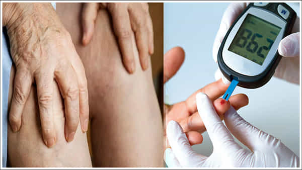 Diabetes: యూరిక్ యాసిడ్ పెరిగితే డయాబెటిస్ పేషెంట్లకు ప్రమాదం.. నివారించడం ఎలా?