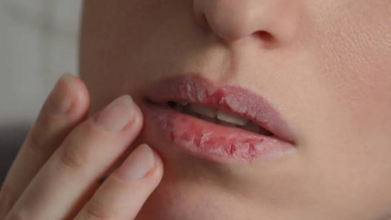 పగటిపూట బయటకు వెళితే సన్‌స్క్రీన్ రాసుకోవడం మర్చిపోకూడదు. శీతాకాలంలో సూర్యుడి వేడి హాయిగా అనిపించినా.. చర్మానికి తీవ్రమైన హానిని కలిగిస్తుంది. సన్‌టాన్ అవుతుంది. కాబట్టి చలికాలంలో బ్రాడ్ స్పెక్ట్రమ్ సన్‌స్క్రీన్ ఉపయోగించడం మంచిది. అలాగే చలికాలంలో పెదవులు పగిలిపోవడం సర్వసాధారణం. కానీ నిర్లక్ష్యం చేయకూడదు. పెదవులపై మాయిశ్చరైజర్ లేదా లిప్ బామ్‌ను క్రమం తప్పకుండా రాసుకుంటూ ఉండాలి.