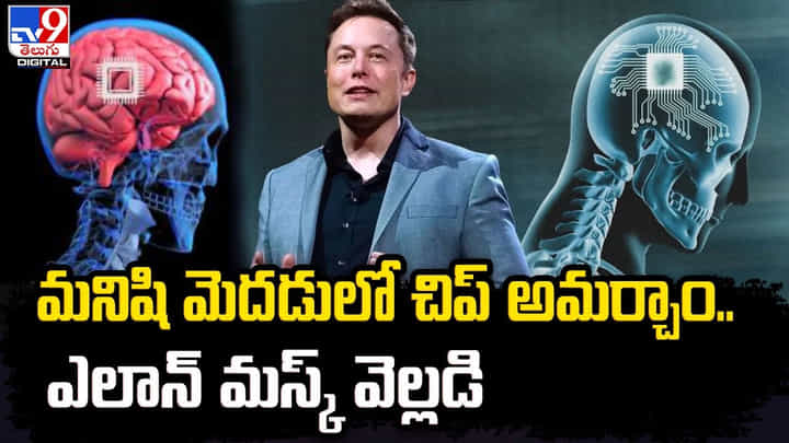 మనిషి మెదడులో చిప్ అమర్చాం.. ఎక్స్ వేదికగా ఎలాన్ మస్క్ ప్రకటన మనిషి మెదడులో చిప్ అమర్చాం.. ఎక్స్ వేదికగా ఎలాన్ మస్క్ ప్రకటన