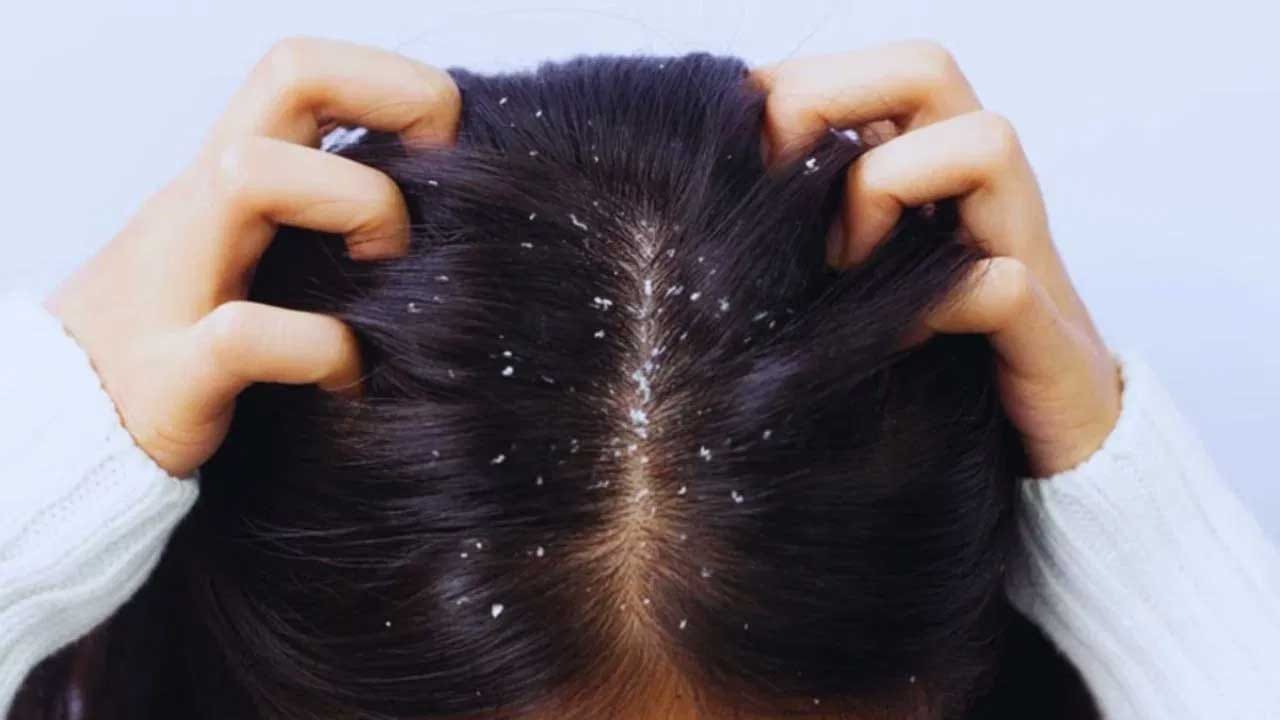 కొబ్బరి నీళ్లను జుట్టు సంరక్షణకు ఎలా ఉపయోగించాలో ఇక్కడ చూద్దాం.. ముందుగా రోజ్ వాటర్, కొబ్బరి నీళ్ళు తీసుకుని, రెండింటినీ బాగా మిక్స్ చేసి జుట్టుకు అప్లై చేయాలి. కొంత సమయం తరువాత, జుట్టును సాదారణ నీళ్తో బాగా కడగాలి.