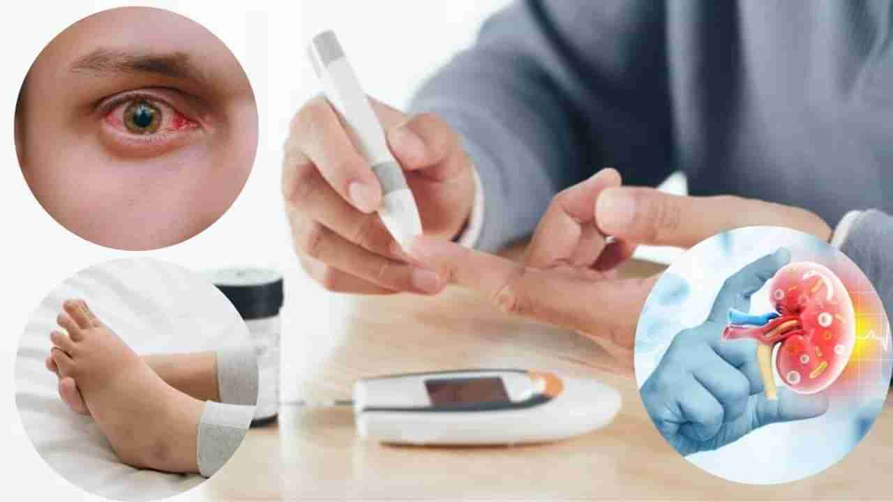 Type 2 Diabetes: మధుమేహం వ్యాధిగ్రస్తుల్లో ఈ 5 శరీర భాగాలు దెబ్బతింటాయని మీకు తెలుసా..? అప్రమత్తంగా లేకపోతే తీరని నష్టం