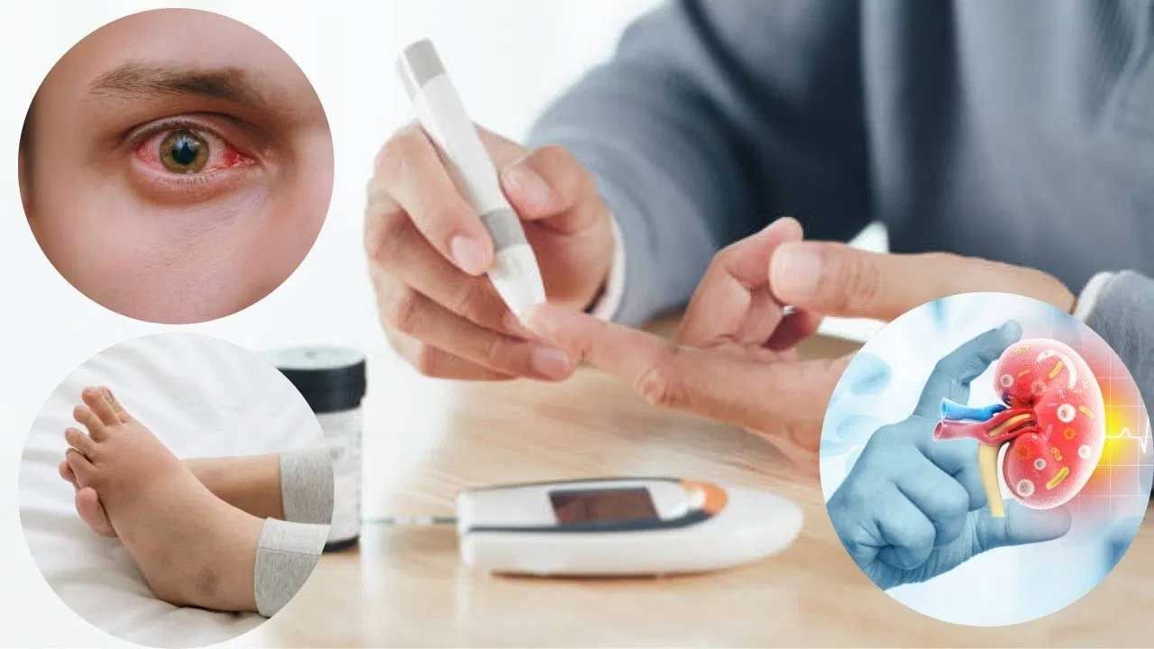 Type 2 Diabetes: మధుమేహం వ్యాధిగ్రస్తుల్లో ఈ 5 శరీర భాగాలు దెబ్బతింటాయని మీకు తెలుసా..? అప్రమత్తంగా లేకపోతే తీరని నష్టం