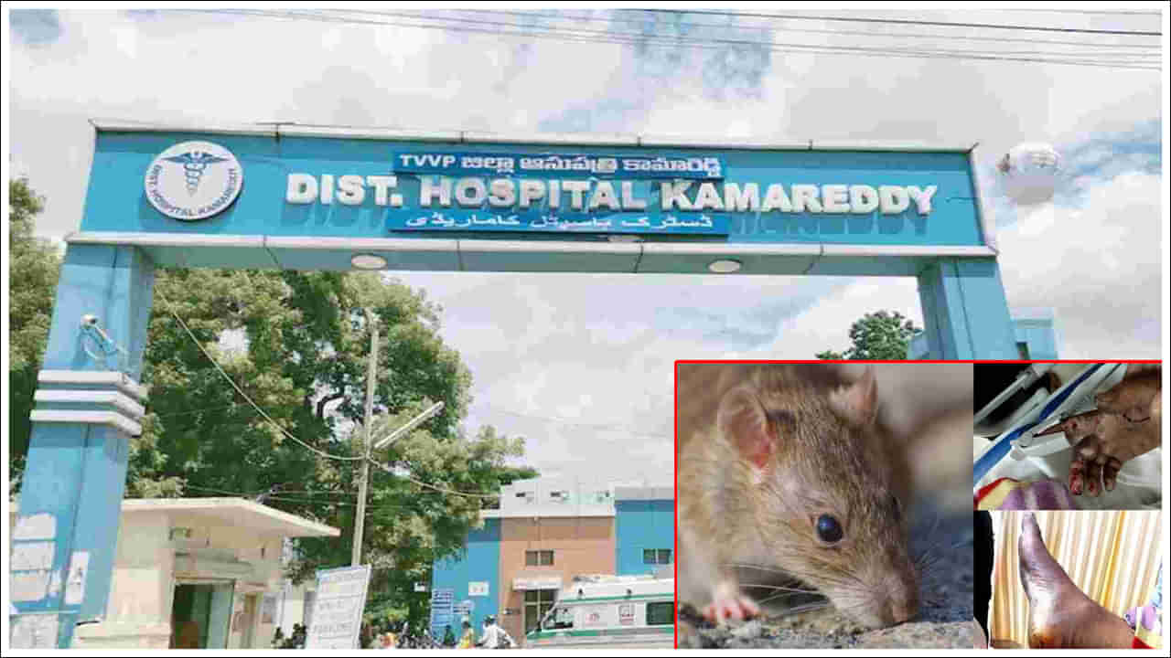 ప్రభుత్వ ఆస్పత్రి ఐసీయూలో రోగిని ఎలుకలు కరిచిన ఘటనపై ప్రభుత్వం సీరియస్‌.. డాక్టర్లపై వేటు