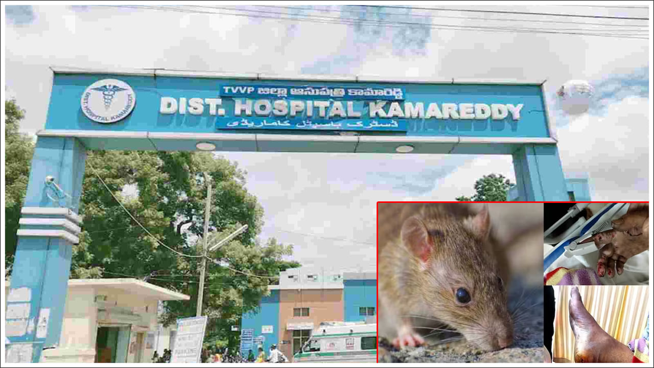 ప్రభుత్వ ఆస్పత్రి ఐసీయూలో రోగిని ఎలుకలు కరిచిన ఘటనపై ప్రభుత్వం సీరియస్.. డాక్టర్లపై వేటు