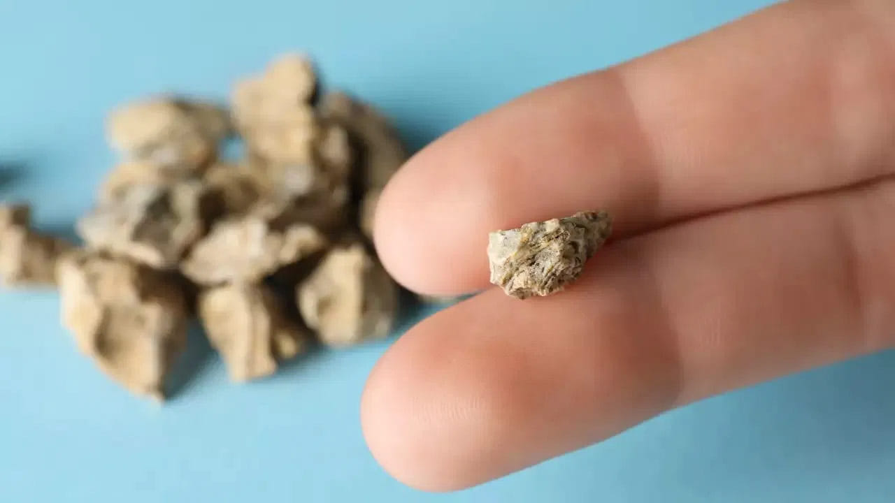 అనారోగ్యకరమైన జీవనశైలి, క్రమరహిత ఆహారపు అలవాట్లు, వేపుడు పదార్థాలను తినే ధోరణి వంటి అలవాట్ల వల్ల మూత్రపిండాలపై ప్రభావం చూపుతుంది. కిడ్నీలకు సంబంధించిన సమస్య ఏదైనా ఉంటే, అది శరీరంలోని ఇతర భాగాలపై కూడా ప్రభావం చూపుతుంది. కిడ్నీ ఇన్ఫెక్షన్, కిడ్నీ క్యాన్సర్, కిడ్నీ ఫెయిల్యూర్ కాకుండా నేటి కాలంలో అధికమంది కిడ్నీ స్టోన్స్ వంటి సమస్యలతో కూడా ఎక్కువగా బాధపడుతున్నారు.