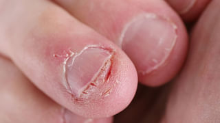 Almond Oil: మలబద్ధకం, జుట్టు రాలడం, స్కిన్ సమస్యలకు ఒకటే ఉపశమనం.. బాదం నూనెను ఇలా ఉపయోగించండి