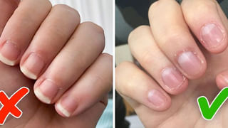 Weight Loss Tips: పసుపును ఇలా వాడితే పొట్ట కొవ్వు మాయమై సన్నబడటం ఖాయం..!