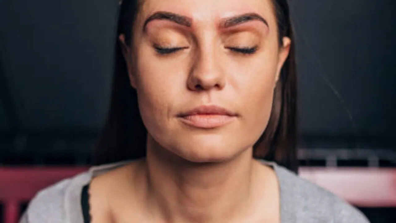 Onion Juice for Skin Care ముఖంపై మచ్చలు, మొటిమల నివారణకు ఈ క్రీమ్