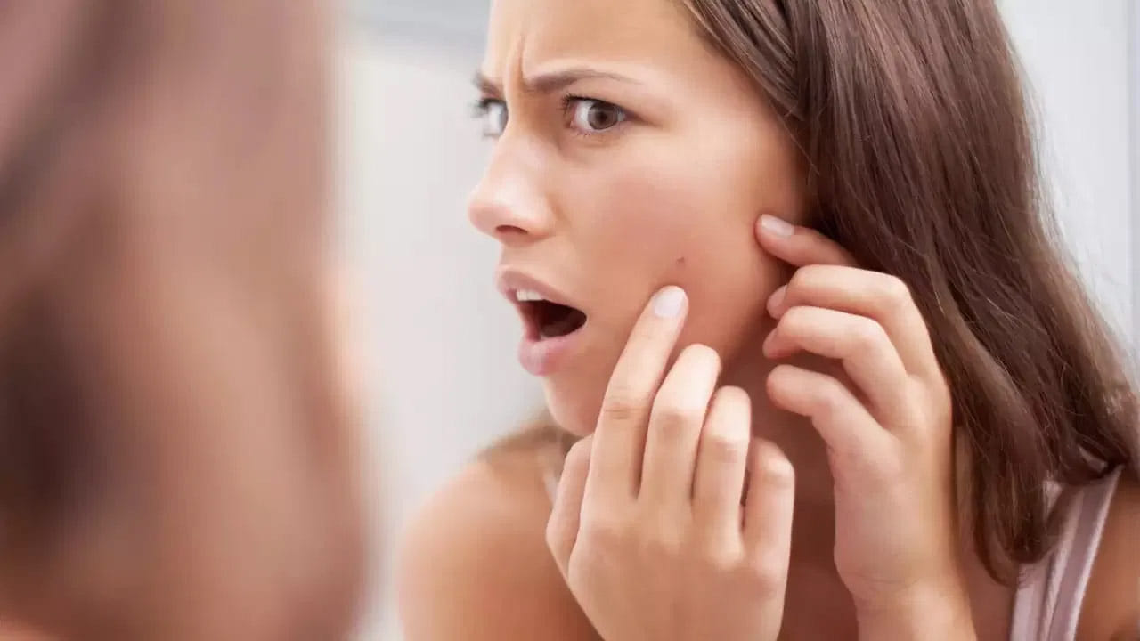 చాలా మంది ఒత్తిడి నుంచి ఉపశమనం కోసం కప్పు కాఫీ తాగుతారు. లేదంటే మరేదైనా కారణంతో రోజులో మరిన్ని సార్లు కాఫీ లేదా టీ తాగే అలవాటు ఉంటుంది. నిజానికి ఒత్తిడి, అనారోగ్యకరమైన ఆహారం ఇవన్నీ కూడా ముఖ చర్మాన్ని ప్రభావితం చేస్తాయి. అలా ఒత్తిడి ఎదుర్కోన్న రోజుల్లో.. ఉదయం లేచి అద్దం ముందు నిలబడితే కొన్నిసార్లు మీరే ఆశ్చర్యపోతారు. ముఖం చర్మంపై రాత్రికి రాత్రే మొటిమలు కనిపించాయి. ఇలాంటి అనుభవాన్ని చాలా మంది ఎదుర్కొని ఉంటారు. మరైతే ఎలా వీటి నుంచి ఎలా ఉపశమనం పొందాలి అని ఆలోచిస్తున్నారా? ఈ టిప్స్ ఫాలో అవ్వండి.