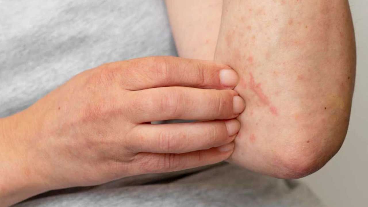 అరటి ఆకులో ఐస్ ముక్కను చుట్టి తలకు మసాజ్ చేయడం వల్ల ఒత్తిడి తగ్గి రిలీఫ్ ఉంటుంది. అరటి ఆకు రసాన్ని అప్లై చేయడం వల్ల చర్మ అలర్జీ ఉన్నవారికి సహాయపడుతుంది. అరటి ఆకు కషాయాన్ని తాగితే జ్వరం కూడా తగ్గుతుంది. అరటి ఆకులను కొద్దిగా నమలడం వల్ల జీర్ణక్రియ మెరుగుపడుతుంది.