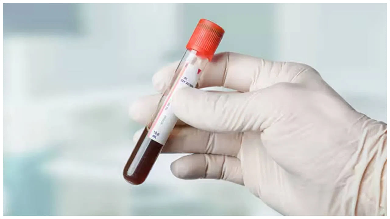 మధుమేహం ఉన్నవారికి లేదా రక్తంలో చక్కెర లెవల్స్‌ గురించి చాలా మందిలో రకరకాల అనుమానాలు తలెత్తుతుంటాయి. రక్తంలో చక్కెర లెవల్స్‌ పరీక్షల గురించి చాలా మందికి తెలియవు. మధుమేమం ఉన్నవారు షుగర్‌ లెవల్స్‌ను గుర్తించేందుకు ఏయే సమయాల్లో టెస్ట్‌లు చేసుకుంటే మంచిదో తెలిసి ఉండాలి.