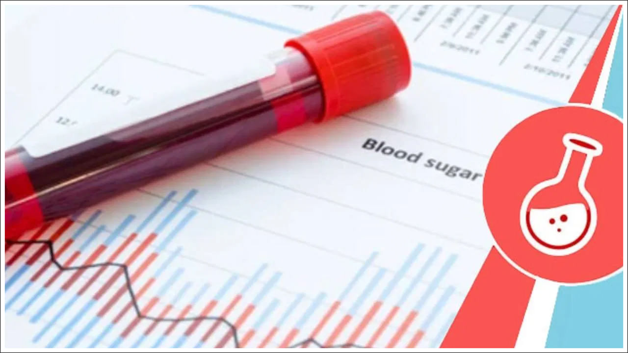 పోస్ట్‌ప్రాండియల్ (PP) షుగర్ పరీక్షను ఎప్పుడు చేయాలనే దానిపై చాలా మందికి ప్రశ్నలు ఉన్నాయి. ఉదయం పరగడుపున.. లేదా ఏదైనా తినగానే 2 గంటల తర్వాత రక్త పరీక్షలు చేసుకుంటే షుగర్‌ లెవల్స్‌ ఎంత ఉన్నాయన్నది తెలుస్తుంది. దీంతో వైద్యులు ఈ రిపోర్ట్‌ను చూసి సరైన మందులను రాసిస్తారు.