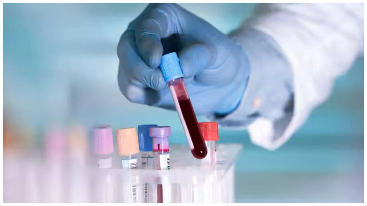 మామూలుగానే అల్పాహారం తీసుకోండి. ఆ తరువాత, మీరు మధ్యాహ్నం తినే సమయానికి తినండి. తినడం ప్రారంభించిన 2 గంటల తర్వాత పీపీ పరీక్ష కోసం రక్తం ఇవ్వాలని సలహా ఇస్తారు వైద్య నిపుణులు.  సాధారణం: 140 mg/dL కంటే తక్కువ (7.8 mmol/L), ప్రీడయాబెటిస్: 140, 199 mg/dL మధ్య (7.8, 11 mmol/L), మధుమేహం: 200 mg/dL (11.1 mmol/L) లేదా అంతకంటే ఎక్కువ ఉంటే.