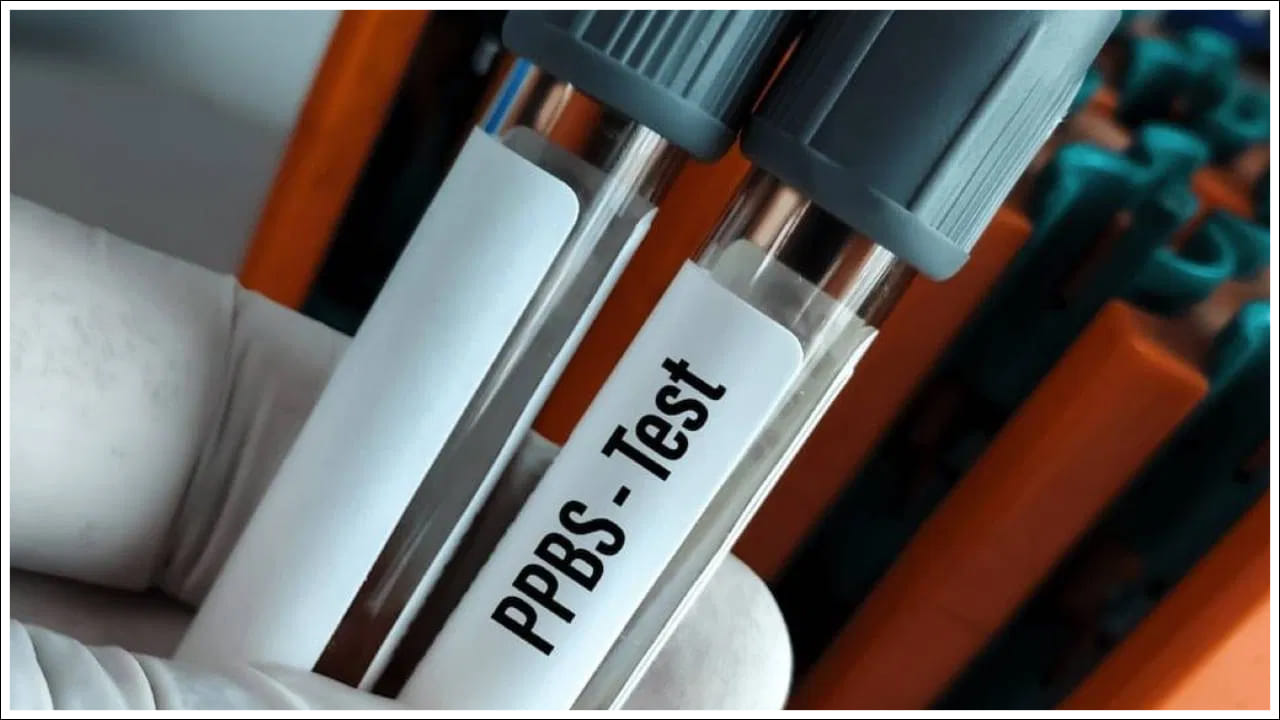 ఐదు రోజుల మాదిరిగానే పరీక్ష రోజు కూడా అదే విధానమైన ఆహారపు అలవాటును ఉంచితేనే పీపీ పరీక్ష సరైన రిపోర్టు వచ్చే అవకాశం ఉందని వైద్యులు చెబుతున్నారు. (నోట్‌- ఇందులోని అంశాలు కేవలం అవగాహన కోసం మాత్రమే. వైద్య నిపుణుల సలహాలు, సూచనల మేరకు అందిస్తున్నాము. ఏవైనా సందేహాలు ఉంటే వైద్యులను సంప్రదించాలని సూచిస్తున్నాము.)