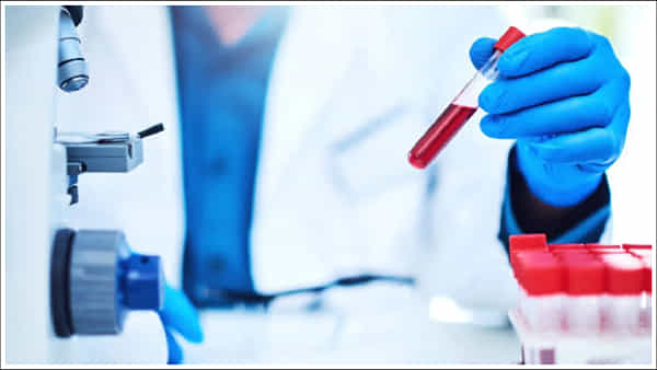 Colorectal Cancer: ఈ రక్త పరీక్ష ద్వారా క్యాన్సర్ను గుర్తించవచ్చు!