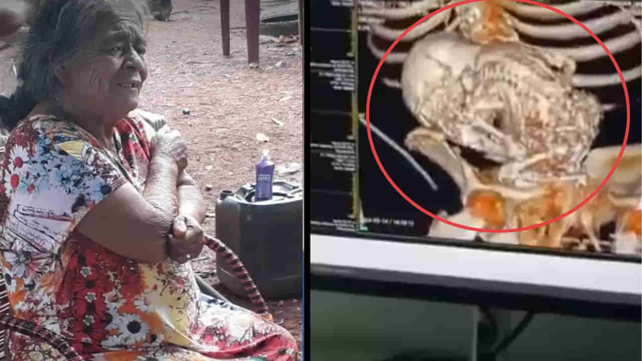 Viral: ఆరోగ్య సమస్యలతో ఆస్పత్రికి వృద్ధురాలు.. కడుపు స్కాన్ చేసి.. స్టన్ అయిన వైద్యులు