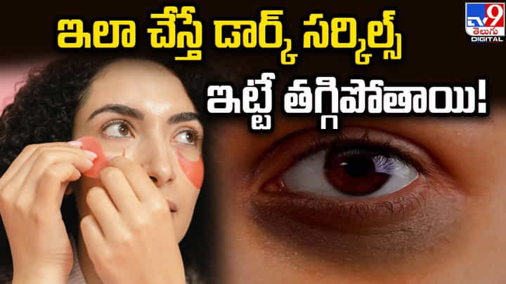 కళ్లచుట్టూ డార్క్ సర్కిల్స్ ఇబ్బంది పెడుతున్నాయా ?? సింపుల్ టిప్స్తో చెక్ పెట్టండి కళ్లచుట్టూ డార్క్ సర్కిల్స్ ఇబ్బంది పెడుతున్నాయా ?? సింపుల్ టిప్స్తో చెక్ పెట్టండి