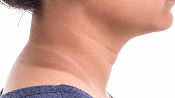 Dark Neck: మెడ నలుపుతో ఇబ్బందిగా ఉందా.. ఈ బెస్ట్ చిట్కాలు మీకోసమే!