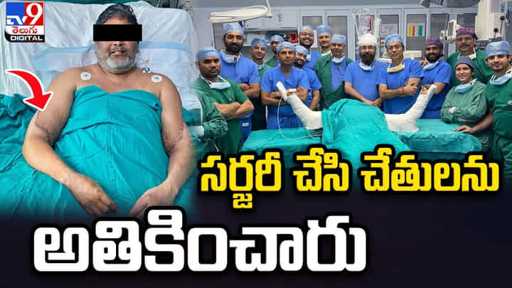 ప్రమాదంలో రెండు చేతులు కోల్పోయాడు !! సర్జరీ చేసి చేతులను అతికించారు ప్రమాదంలో రెండు చేతులు కోల్పోయాడు !! సర్జరీ చేసి చేతులను అతికించారు