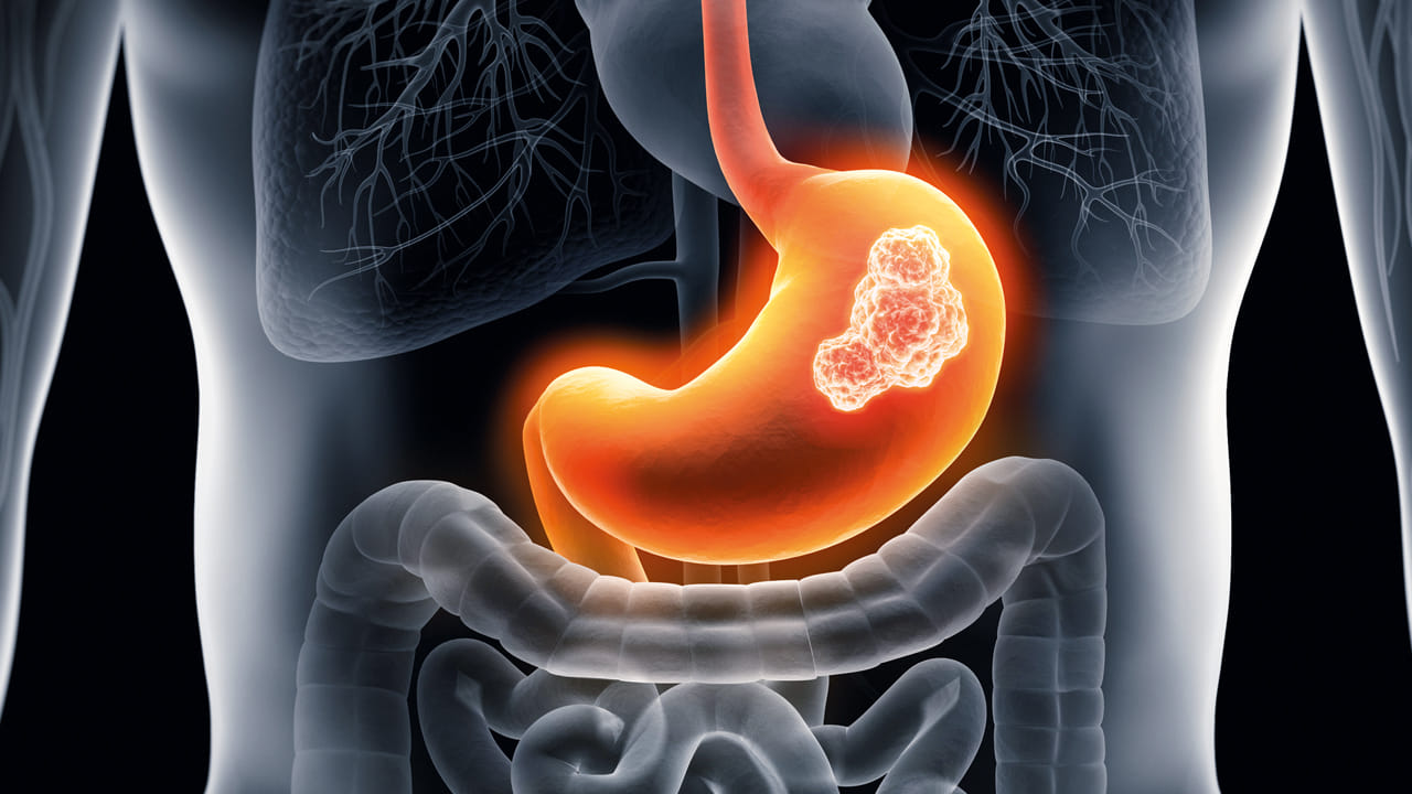 Digestion Problems తిన్న ఆహారం జీర్ణం కావడం లేదా.. ఈ హోమ్ రెమిడీస్‌తో