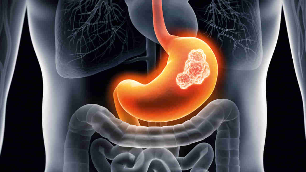 Digestion Problems: తిన్న ఆహారం జీర్ణం కావడం లేదా.. ఈ హోమ్ రెమిడీస్‌తో చెక్ పెట్టండి!