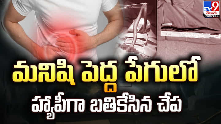 మనిషి పెద్ద పేగులో హ్యాపీగా బతికేసిన చేప !! పరీక్ష చేసి చూసిన డాక్టర్లు షాక్ మనిషి పెద్ద పేగులో హ్యాపీగా బతికేసిన చేప !! పరీక్ష చేసి చూసిన డాక్టర్లు షాక్