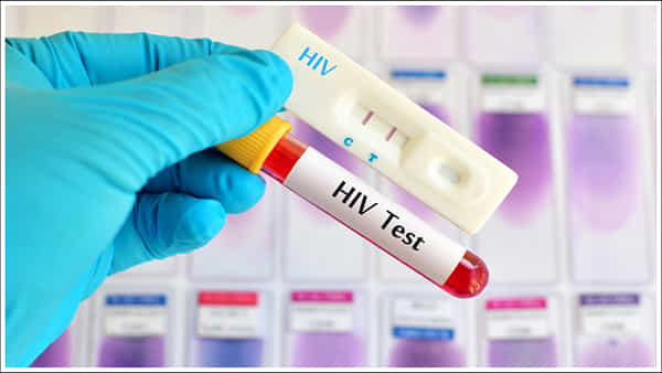 HIV: గుడ్న్యూస్.. శాస్త్రవేత్తల సంచలన విజయం.. ఇక హెచ్ఐవీని పూర్తిగా నయం చేయవచ్చు!
