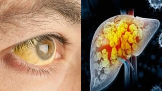 ఈ డ్రింకులు ఆబగా తాగుతున్నారా.? విషంతో సమానం.. బీ కేర్‌ఫుల్.!