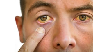 Red Rice Benefits: రెడ్ రైస్ తింటే.. ఊహించనన్ని హెల్త్ బెనిఫిట్స్!