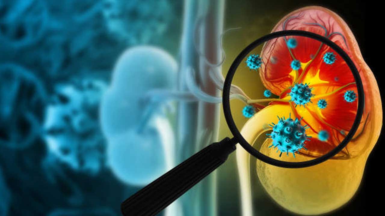 మన శరీరంలో ముఖ్యమైన అవయవాల్లో కిడ్నీలు ఒకటి.. ఈ ప్రత్యేక అవయవాలు శరీరంలోని మురికిని తొలగించడానికి పనిచేస్తాయి.. అటువంటి పరిస్థితిలో, వాటిని జాగ్రత్తగా చూసుకోవడం చాలా ముఖ్యం. తరచుగా కిడ్నీ ఆరోగ్యం పట్ల ప్రజలు నిర్లక్ష్యంగా ఉంటారు.దీని వల్ల కిడ్నీలో మురికి పేరుకుపోవడం ప్రారంభమవుతుంది. అటువంటి పరిస్థితిలో కిడ్నీల్లో రాళ్ళు వచ్చే ప్రమాదం ఉంటుంది. కిడ్నీలో టాక్సిన్స్ పేరుకుపోవడం ప్రారంభించిన వెంటనే ఆహారంలో కొన్ని మార్పులు చేసుకోవాలి. తద్వారా కిడ్నీల్లోని మురికిని సులభంగా తొలగించుకోవచ్చు. 