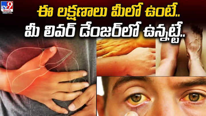 ఈ లక్షణాలు మీలో ఉంటే.. మీ లివర్ డేంజర్లో ఉన్నట్టే ఈ లక్షణాలు మీలో ఉంటే.. మీ లివర్ డేంజర్లో ఉన్నట్టే