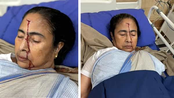 Mamata Banerjee: బెంగాల్ సీఎం మమతా బెనర్జీ తలకు బలమైన గాయం.. ఆసుపత్రికి తరలింపు