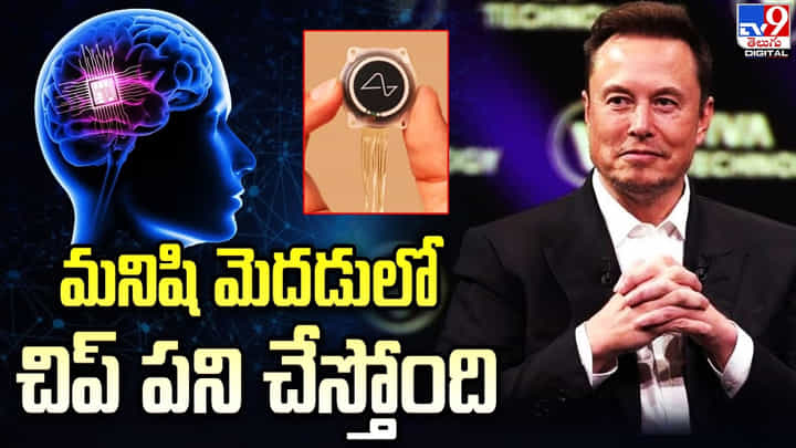సక్సెస్ఫుల్గా పనిచేస్తున్న మనిషి మెదడులో అమర్చిన చిప్ సక్సెస్ఫుల్గా పనిచేస్తున్న మనిషి మెదడులో అమర్చిన చిప్