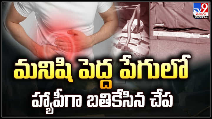 Viral Video: వ్యక్తి కడుపులో బ్రతికున్న ఉన్న చేప.! డాక్టర్స్ కే షాక్ ఇచ్చిన కొత్త కేసు. Viral Video: వ్యక్తి కడుపులో బ్రతికున్న ఉన్న చేప.! డాక్టర్స్ కే షాక్ ఇచ్చిన కొత్త కేసు.