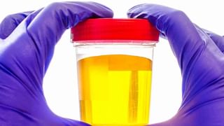 Numbness Problem: కాళ్లు, చేతుల్లో తిమ్మిర్లు ఎక్కువగా వస్తున్నాయా.. ఇలా చెక్ పెట్టండి!