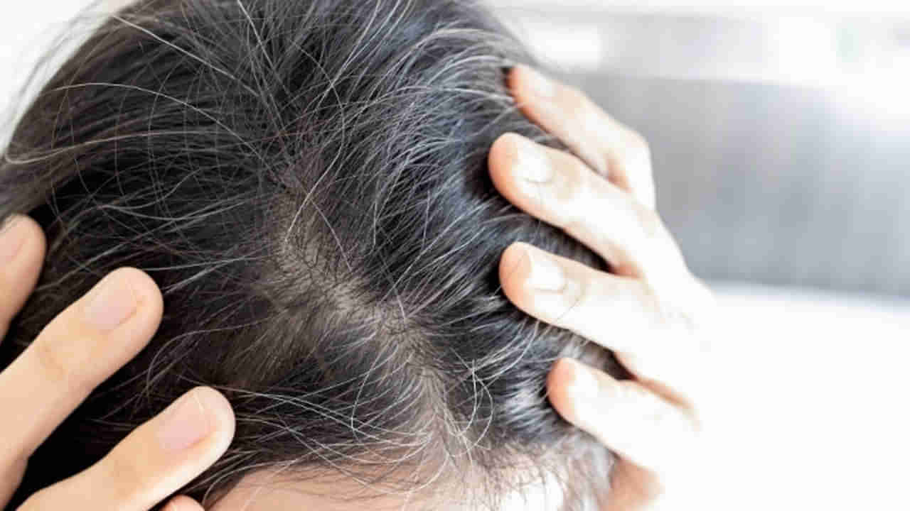 Lifestyle: జుట్టు తెల్లబడడానికి ఇవి కూడా కారణాలని మీకు తెలుసా.?