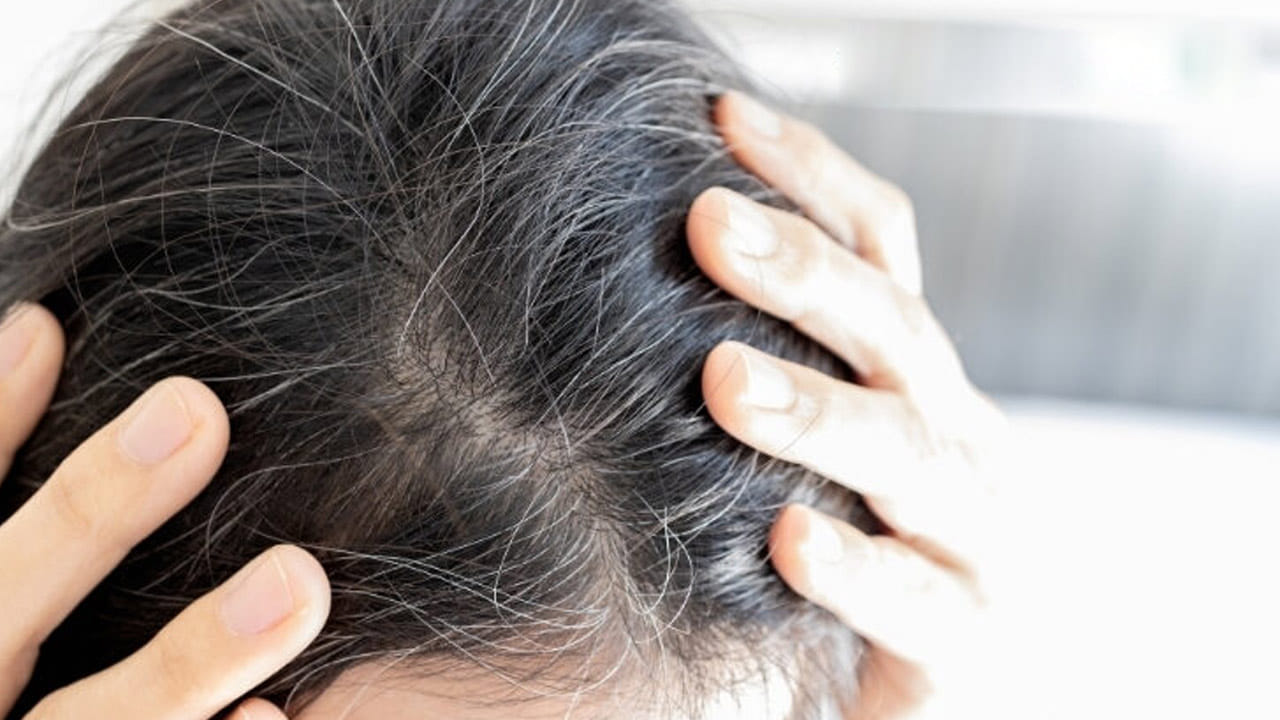 Lifestyle: జుట్టు తెల్లబడడానికి ఇవి కూడా కారణాలని మీకు తెలుసా.?