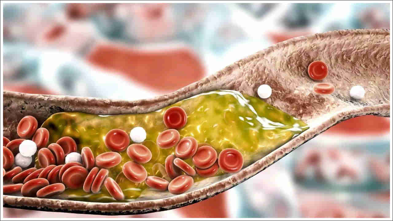 Bad Cholesterol: చెడు కొలెస్ట్రాల్ ఎందుకు పెరుగుతోంది? దీని వల్ల ఎలాంటి సమస్యలు వస్తాయి?