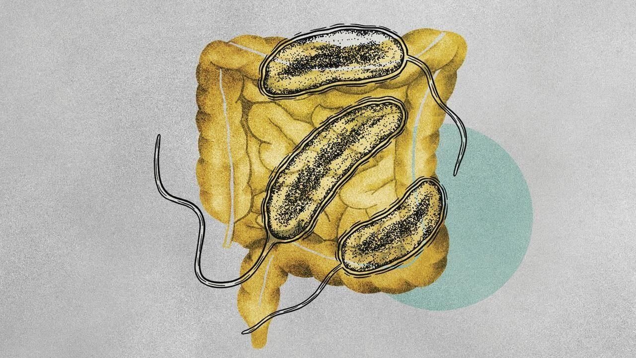 కలుషితమైన ఆహారం, నీరు తీసుకోవడం వల్ల కలరా వ్యాధి వస్తుంది. వైరస్, బ్యాక్టీరియాలు చిన్న ప్రేగుల్లోకి ప్రవేవించి విరోచనాలు, వాంతులకి కారణం అవుతుంది. రోడ్ల పక్కన ఆహారం తీసుకోవడం, వ్యక్తిగత పరిశుభ్రత పాటించకపోవడం వల్ల కూడా కలరా వ్యాప్తి చెందుతుంది. 
