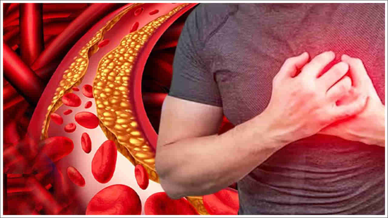 Cholesterol Problem: యువతలో కొలెస్ట్రాల్ ఎందుకు పెరుగుతోంది? సీనియర్ కార్డియాలజిస్ట్ షాకింగ్‌ విషయాలు