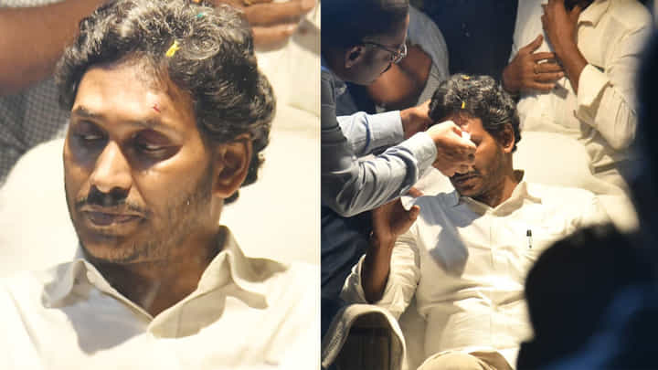 Attack on YS Jagan: సీఎం జగన్పై రాళ్ల దాడి ఘటనపై రాజకీయ రగడ.. వైసీపీ-టీడీపీ మధ్య మాటల యుద్ధం.. Attack on YS Jagan: సీఎం జగన్పై రాళ్ల దాడి ఘటనపై రాజకీయ రగడ.. వైసీపీ-టీడీపీ మధ్య మాటల యుద్ధం..